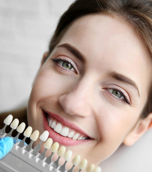 Na czym polega zabieg wybielania zębów i jakie wyróżniamy metody wybielania?