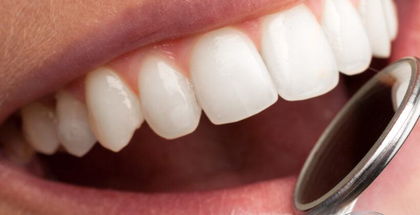 Implant zęba Krosno Implant zęba Krosno