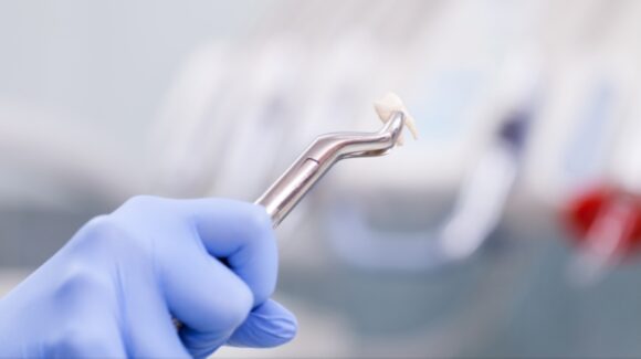 Usuwanie ósemek — sprawnie i bez lęku!