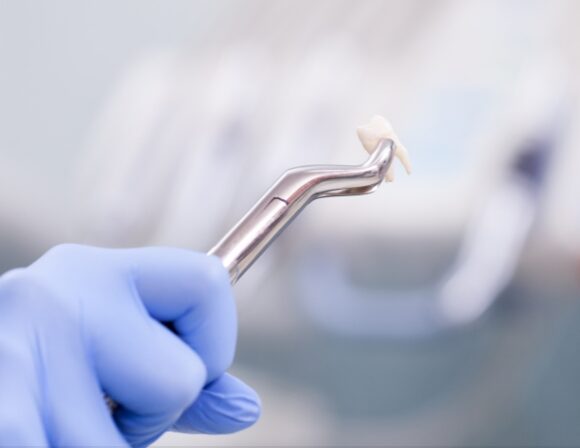 Usuwanie ósemek — sprawnie i bez lęku!