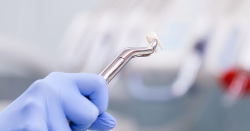 Usuwanie ósemek — sprawnie i bez lęku! Usuwanie ósemek — sprawnie i bez lęku!